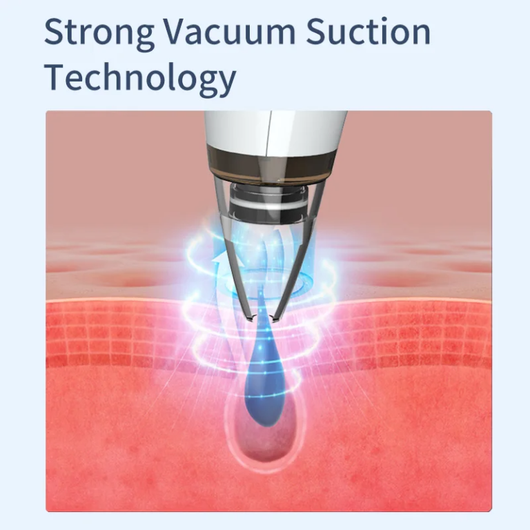 Blackhead Remover Vacuum Acne Pimple Black Spot